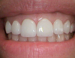 Dr. Stachowicz | Dentist Lebanon PA Dentist